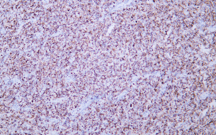 CD20 (2J9) Mouse Monoclonal Antibody
