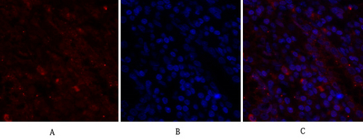 BRCA1 Rabbit Polyclonal Antibody