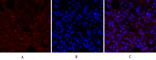 BRCA1 Rabbit Polyclonal Antibody