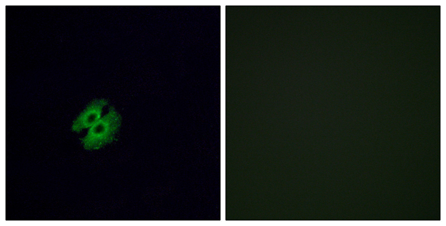 2g2 Olfactory receptor 2G2 Rabbit Polyclonal Antibody