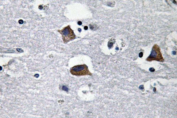 Sdf Rabbit SDF-1 Rabbit Polyclonal Antibody