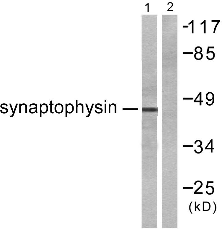 SYP Rabbit Polyclonal Antibody