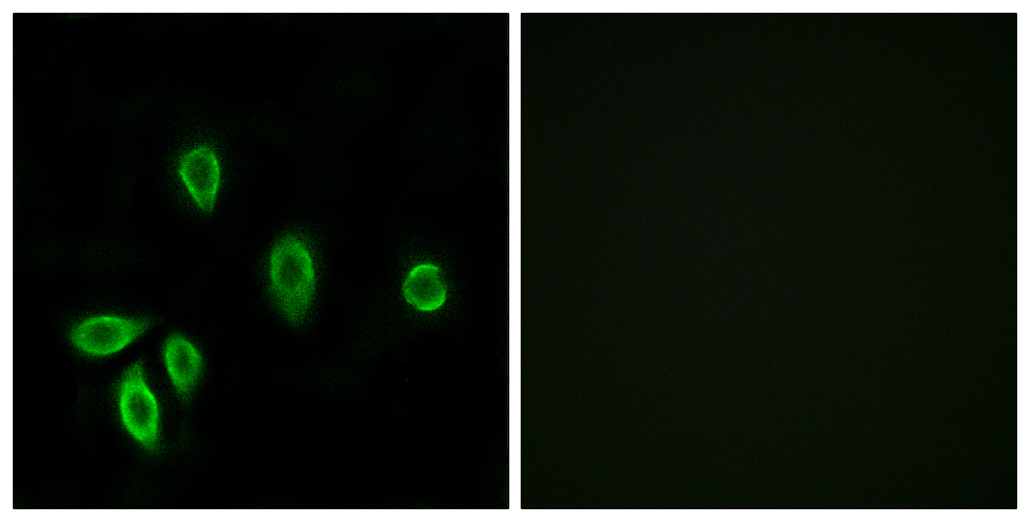 TRH-R1 Rabbit Polyclonal Antibody