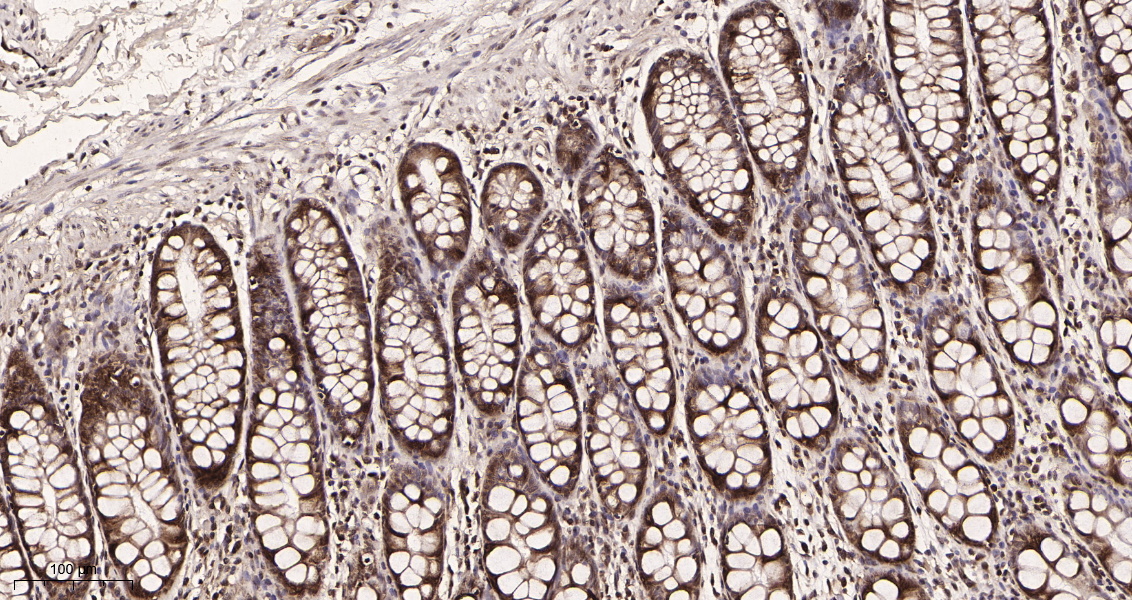 TATA Box Binding Protein (1E4) Rabbit Monoclonal Antibody