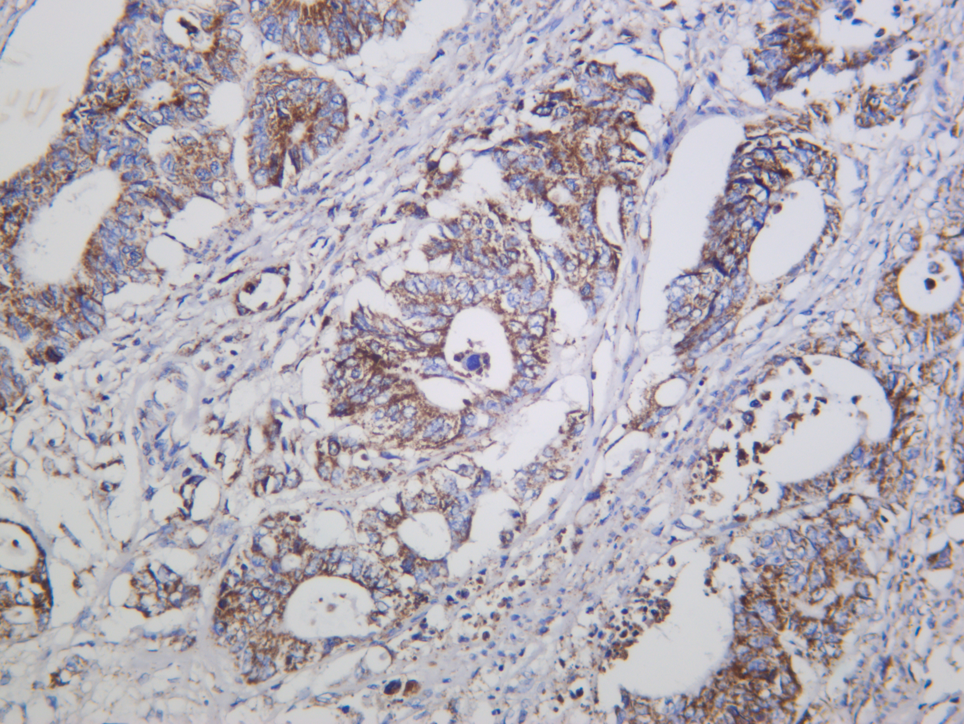 Cleaved Caspase-3 (Asp175) (2Q1) Rabbit Monoclonal Antibody