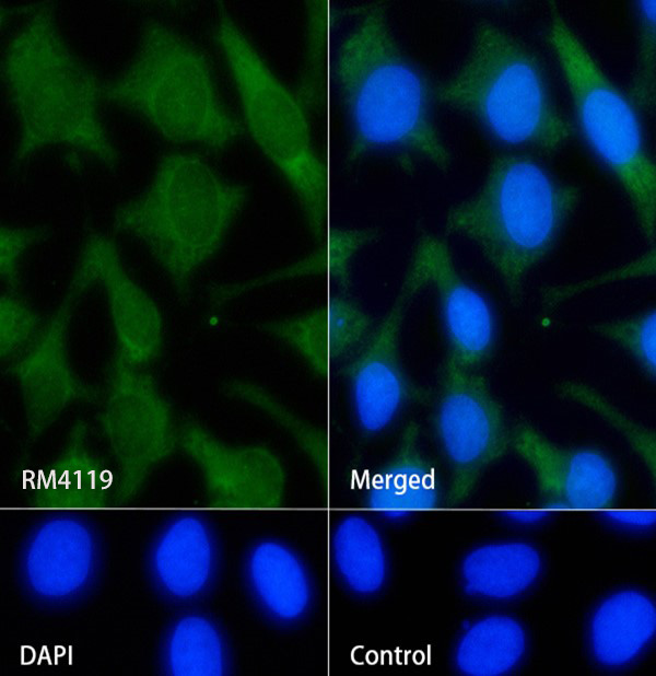 ERK1 (3Y8) Rabbit Monoclonal Antibody